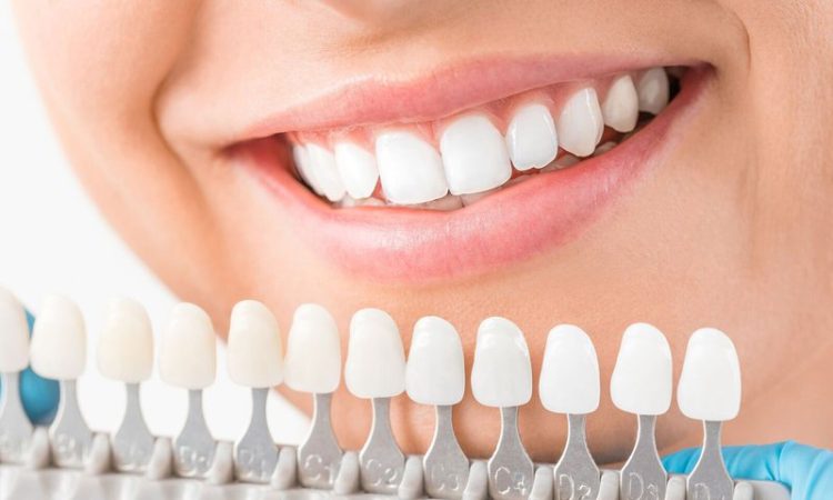 The Complete Guide to Choosing a Dental Spa: Everything to Know